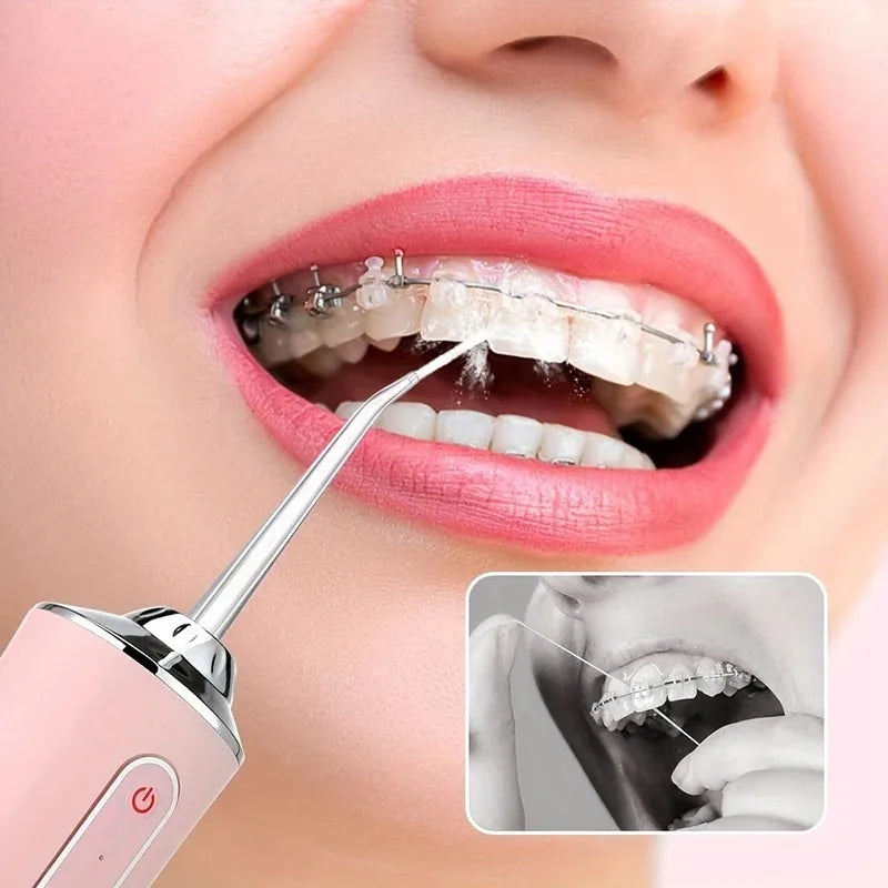 White Shine water flosser being used to clean between teeth and around braces